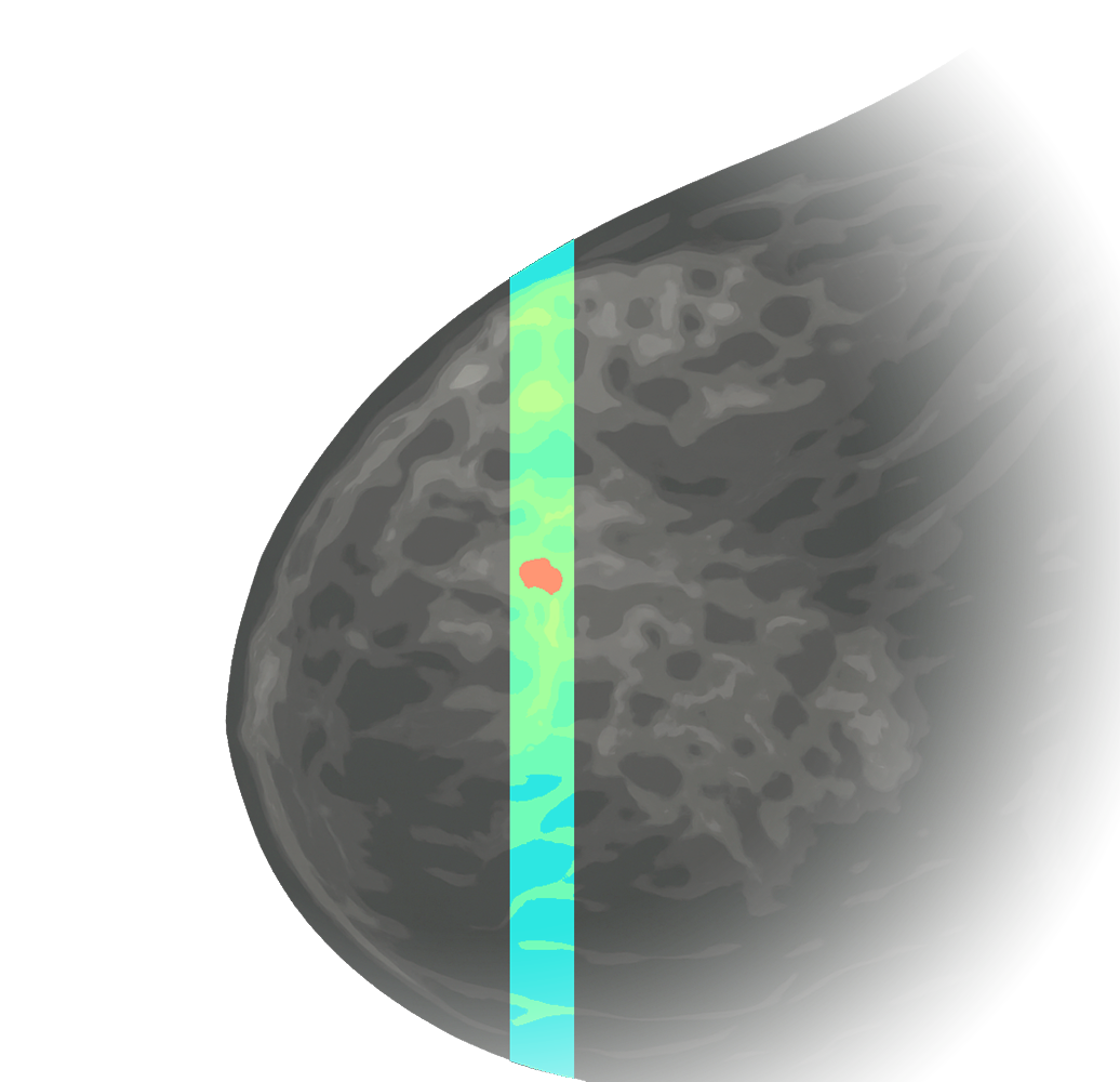 Light-based 4D Mammography concept illustration